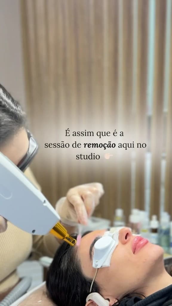 Sessão de remoção a laser no Jenifer Amanda Studio